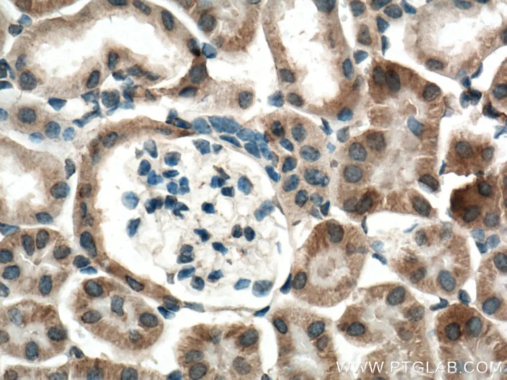 P62/SQSTM1 antibody (55274-1-AP) | Proteintech