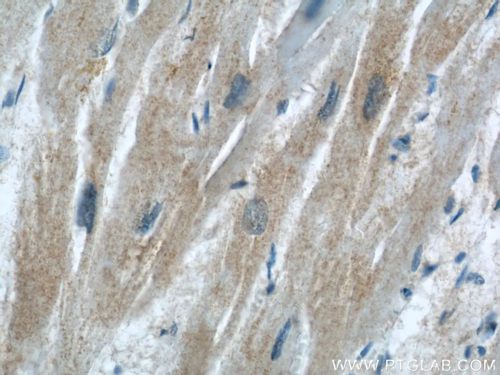 P62/SQSTM1 antibody (55274-1-AP) | Proteintech