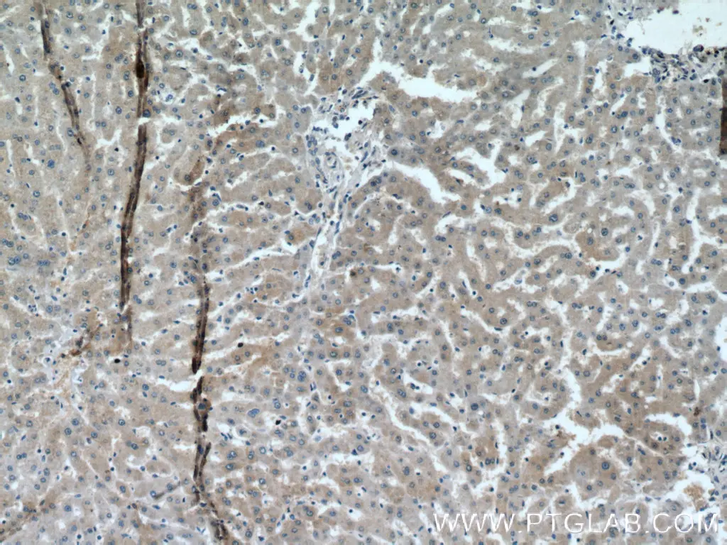 SRD5A1 antibody (66329-1-Ig) | Proteintech