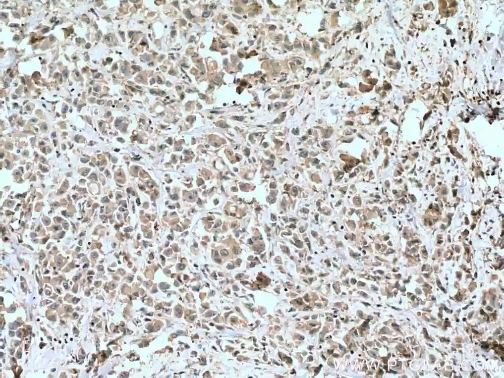 STK11/LKB1 antibody (10746-1-AP) | Proteintech