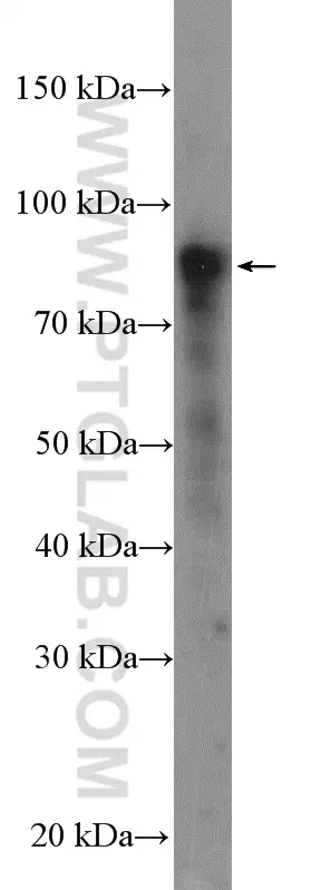 SUN2 Rabbit Polyclonal antibody