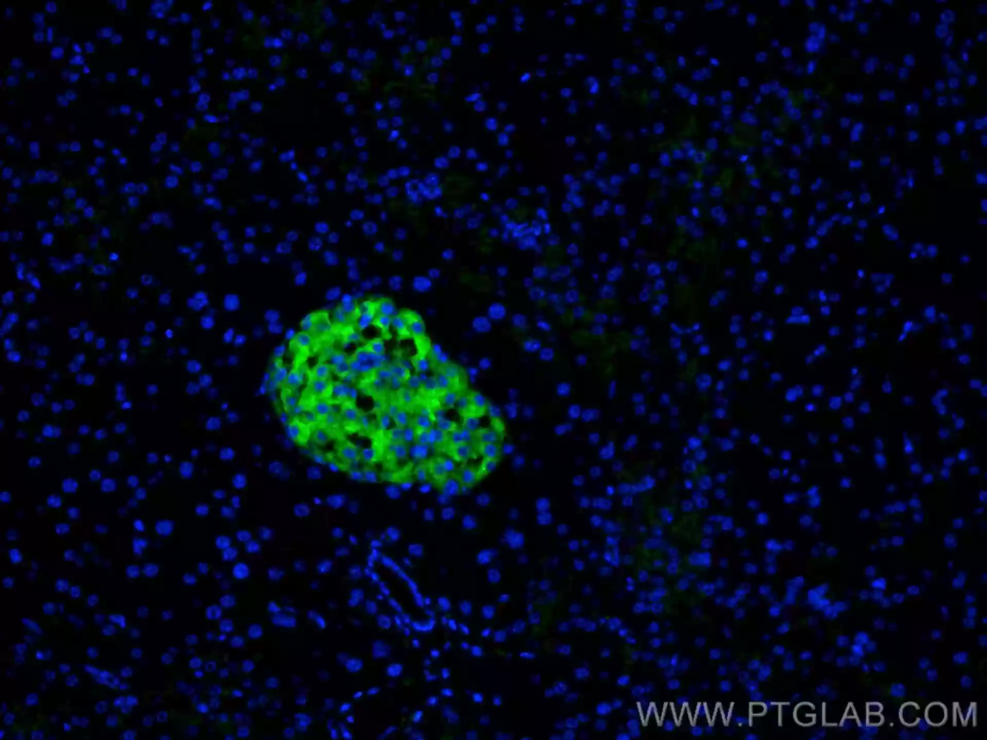 Synaptophysin antibody (67864-1-Ig) | Proteintech