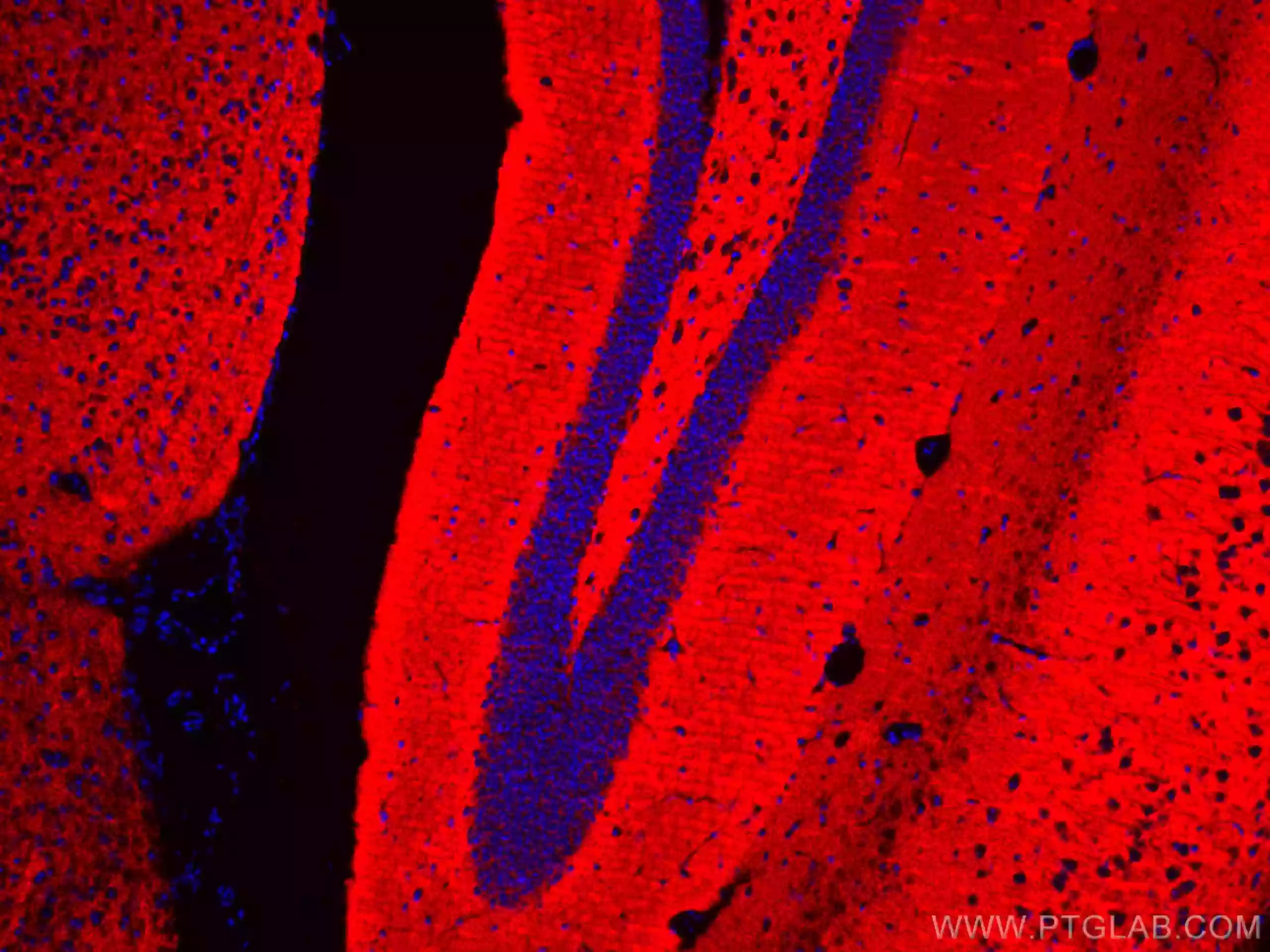 Synaptophysin antibody (CL594-67864) | Proteintech