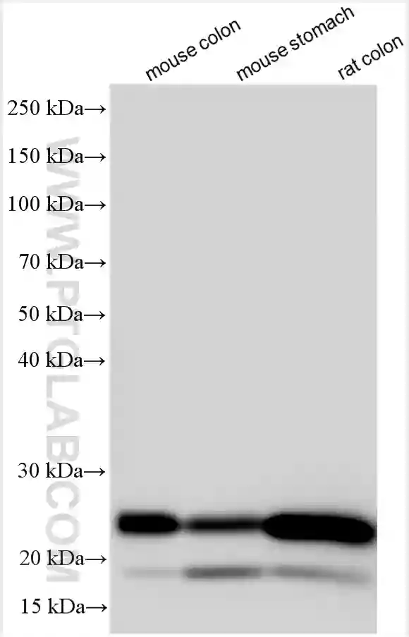 transgelin/SM22 antibody (10493-1-AP) | Proteintech