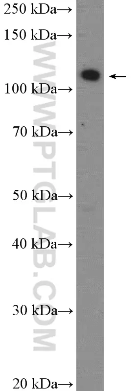TAOK1 antibody (26250-1-AP) | Proteintech