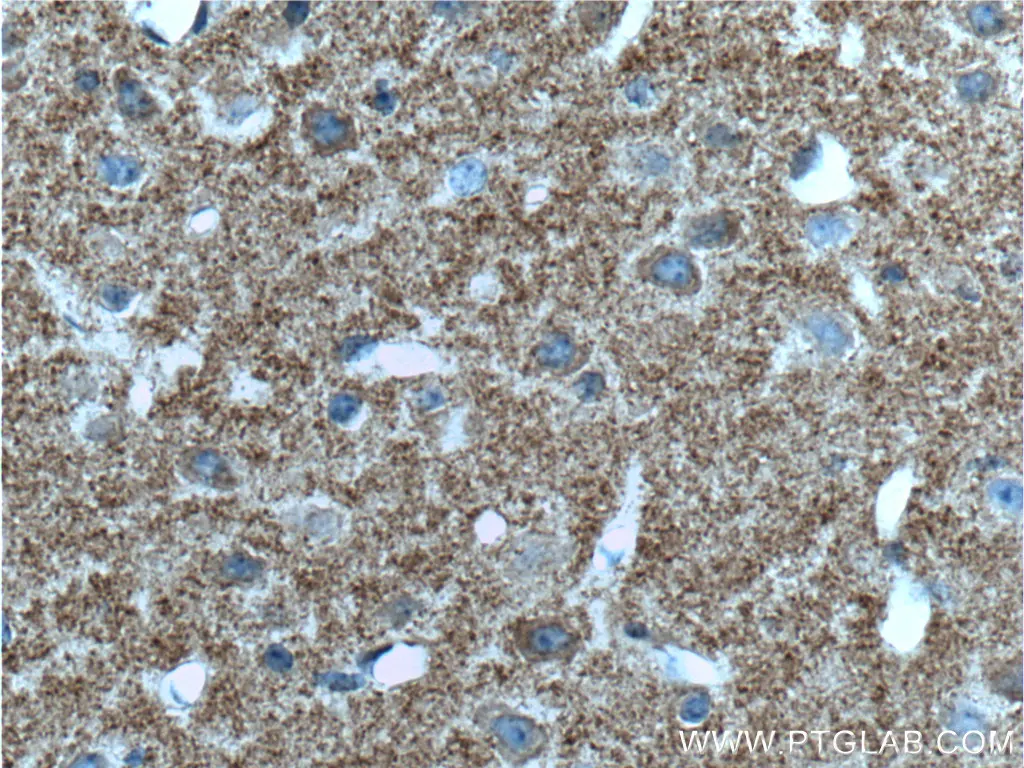TAU antibody (66499-1-Ig) | Proteintech