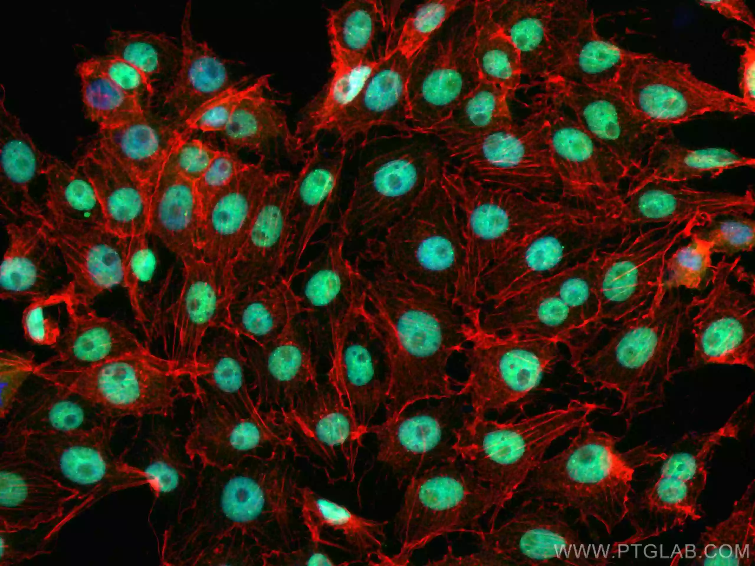 Immunofluorescence staining of SH-SY5Y using TDP-43 Recombinant antibody