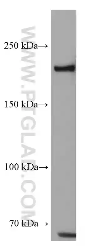 TEX14 antibody (67982-1-Ig) | Proteintech