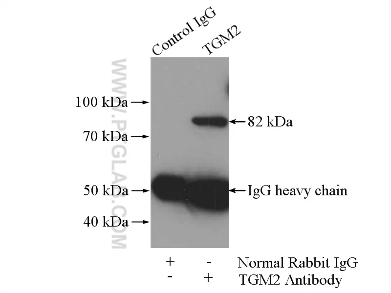 TGM2 antibody (15100-1-AP) | Proteintech