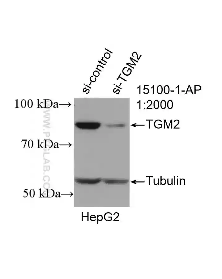 TGM2 antibody (15100-1-AP) | Proteintech