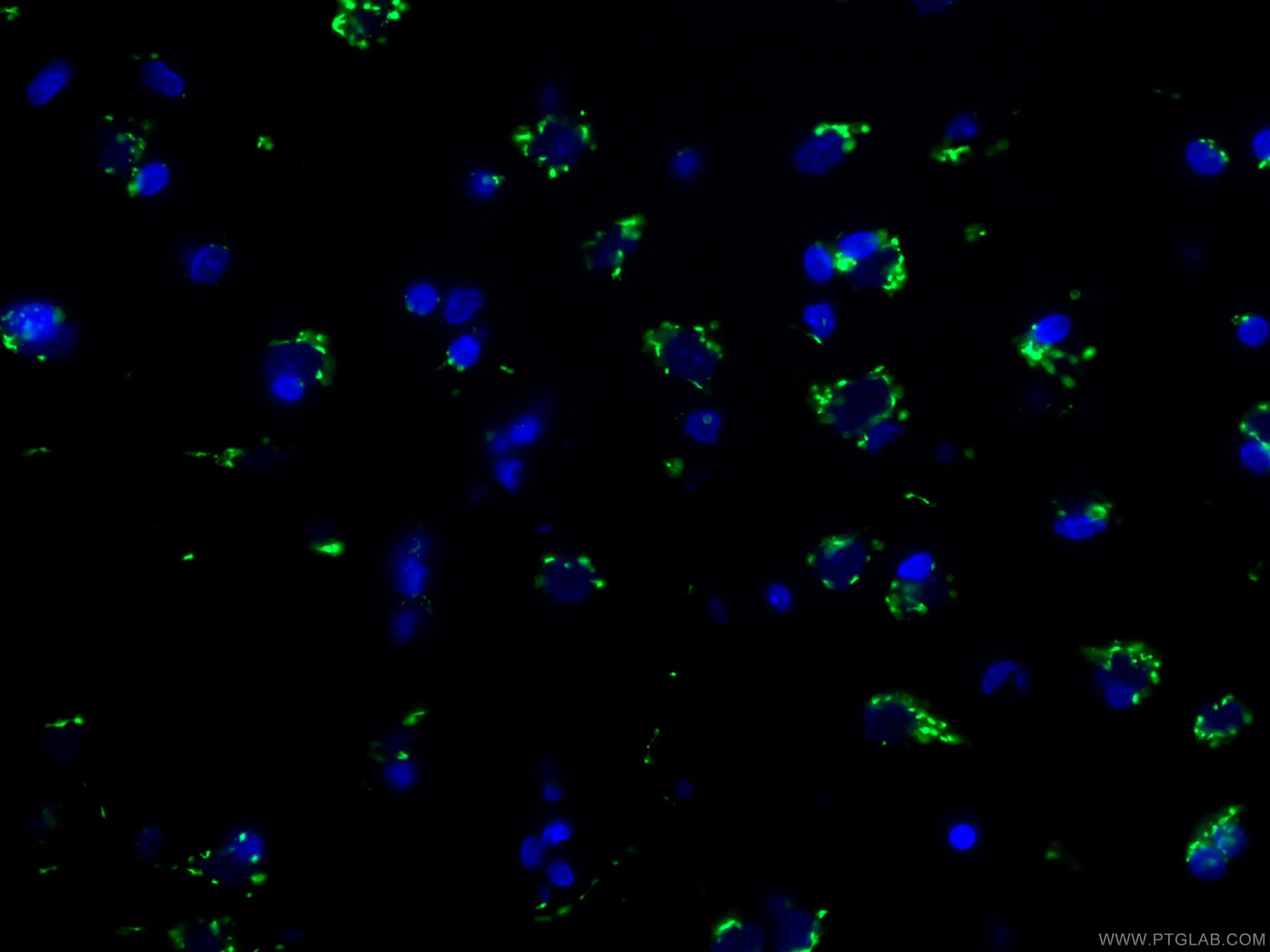 TGN46 antibody (13573-1-AP) | Proteintech