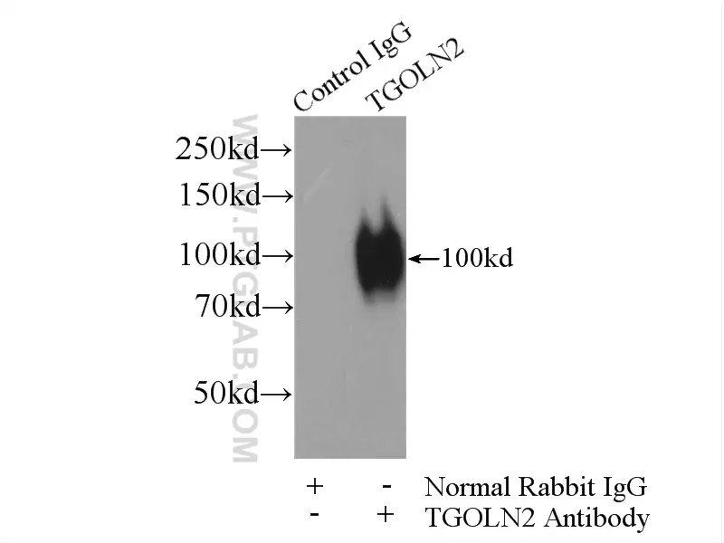 TGN46 antibody (13573-1-AP) | Proteintech