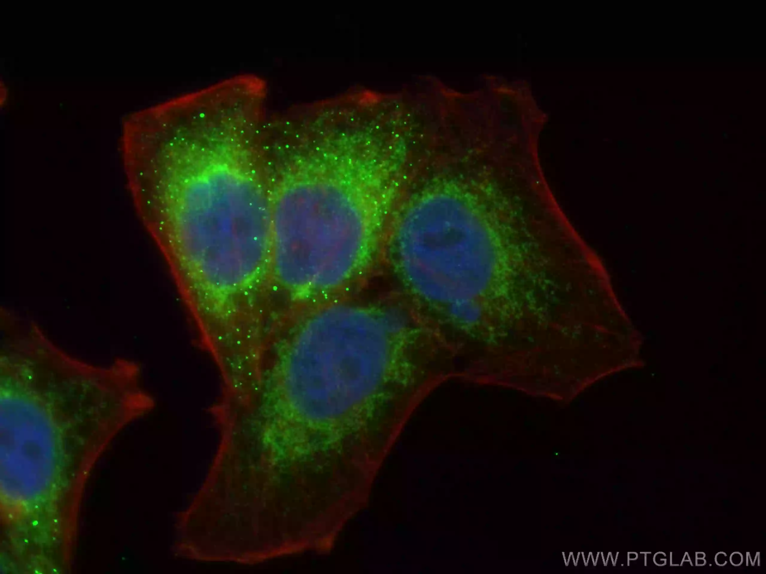 Immunofluorescent analysis of fixed HepG2 cells using Tim23 antibody