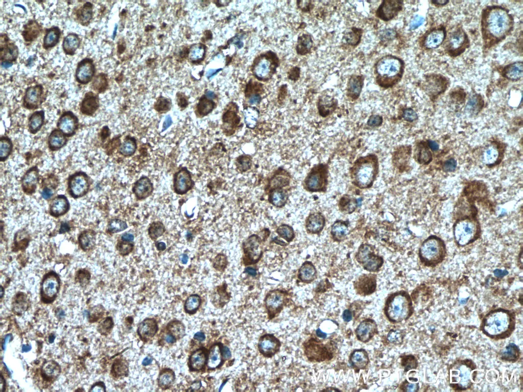 TLR4 antibody (19811-1-AP) | Proteintech