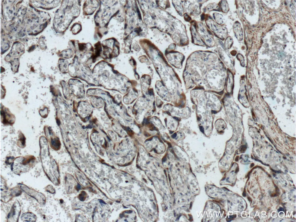 TLR4 antibody (19811-1-AP) | Proteintech