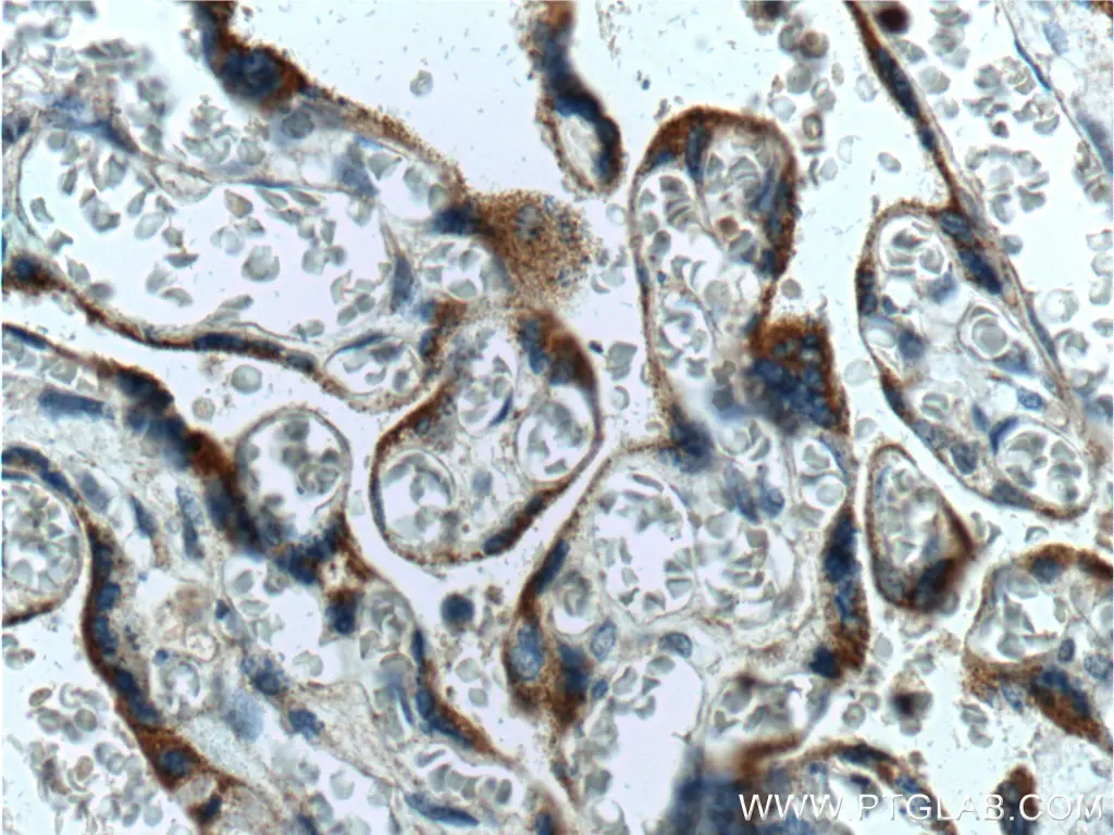 TLR4 antibody (19811-1-AP) | Proteintech