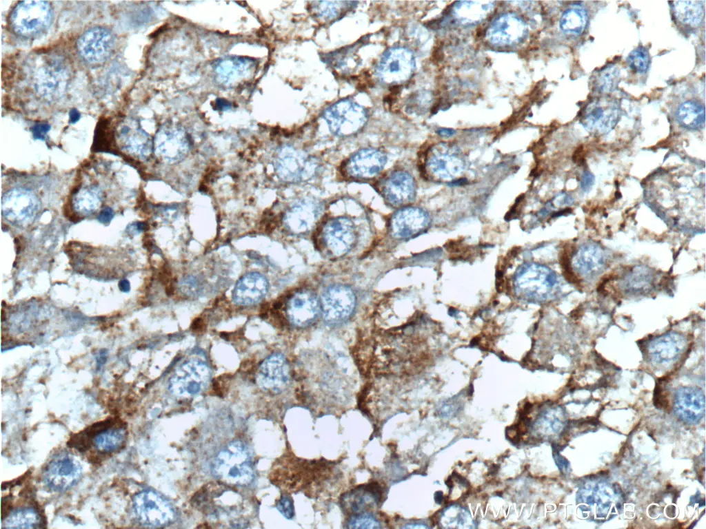 TLR4 antibody (19811-1-AP) | Proteintech