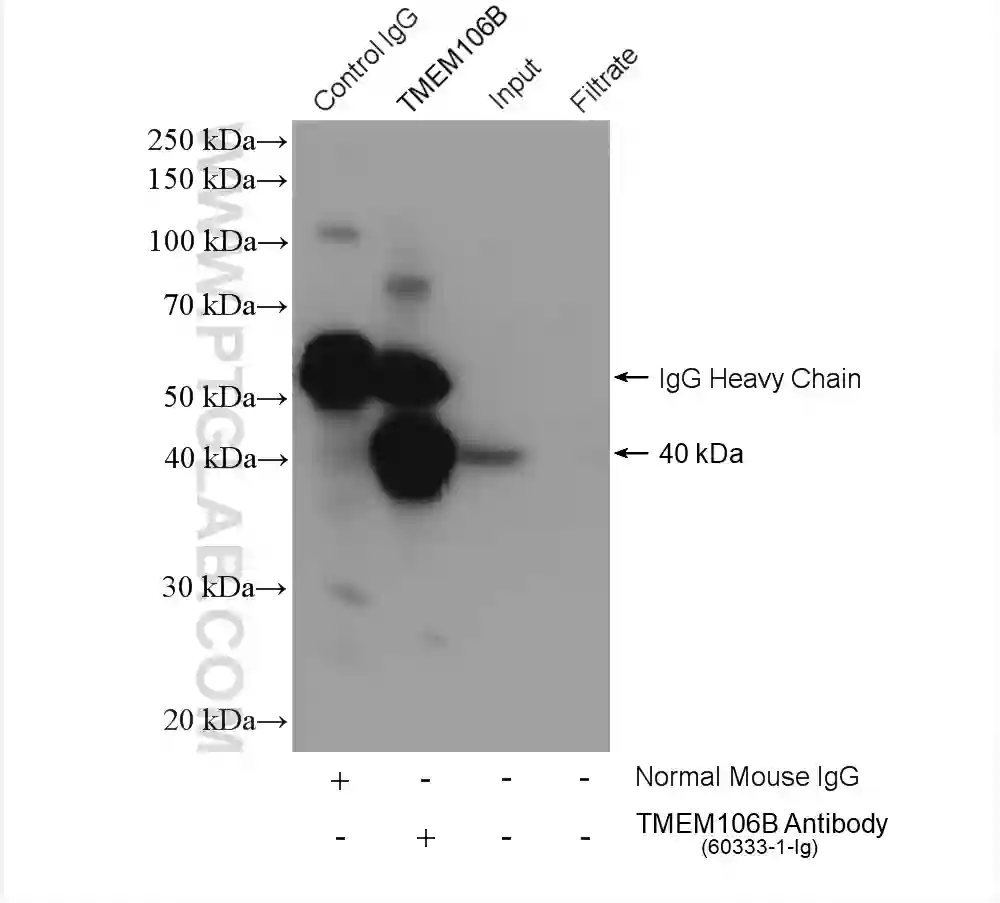 TMEM106B (1-46aa) antibody (60333-1-Ig) | Proteintech