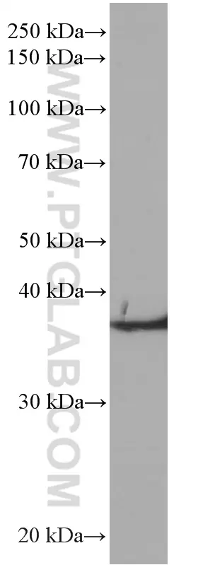 TMEM173/STING antibody (66680-1-Ig) | Proteintech