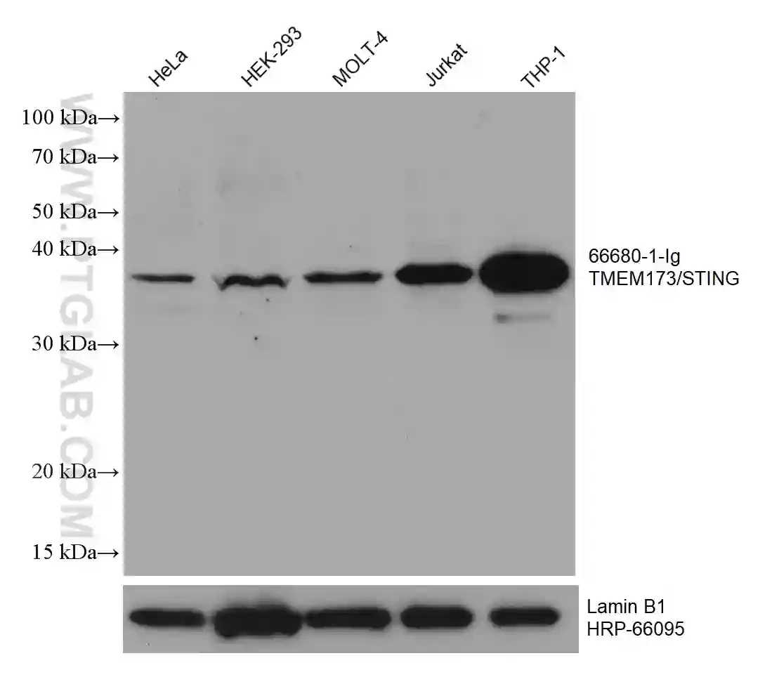 TMEM173/STING antibody (66680-1-Ig) | Proteintech