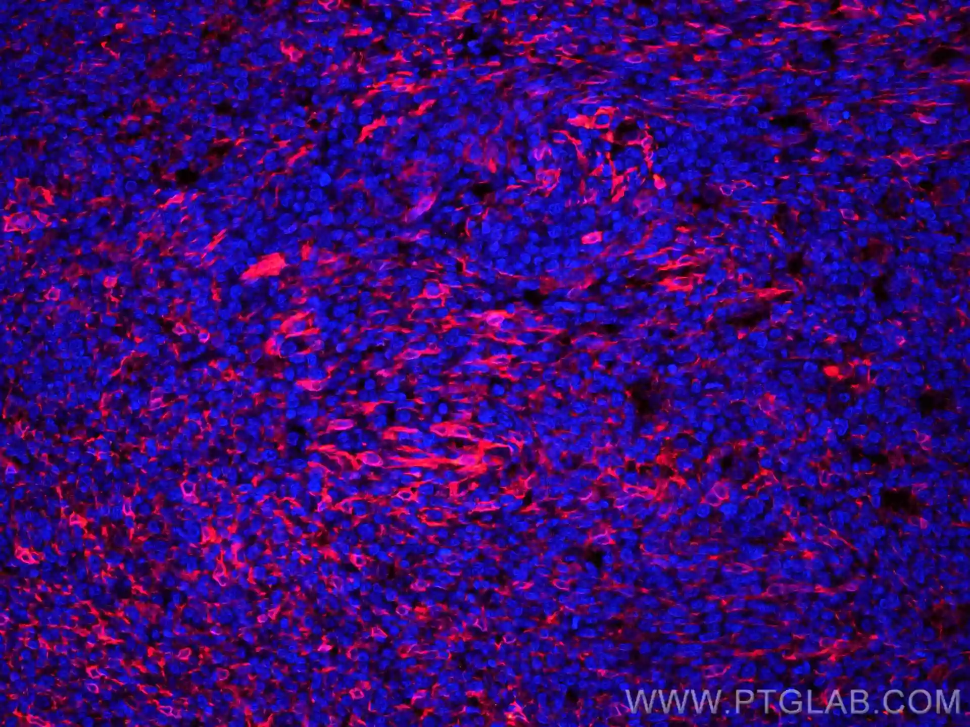 TMEM173/STING antibody (CL594-19851) | Proteintech