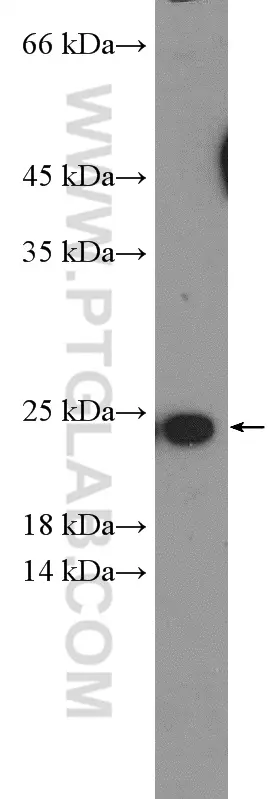 TNFSF12 antibody (12537-1-AP) | Proteintech