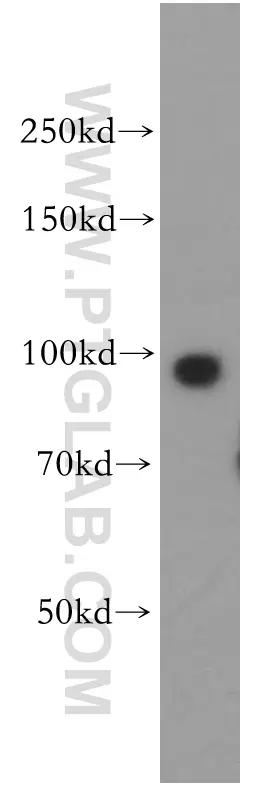 TNPO2 antibody (17831-1-AP) | Proteintech