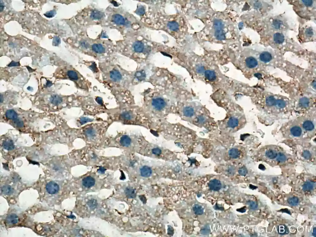 TOM20 antibody (11802-1-AP) | Proteintech