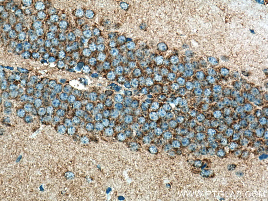 Immunohistochemical analysis of paraffin-embedded mouse brain tissue slide using TOM20 antibody