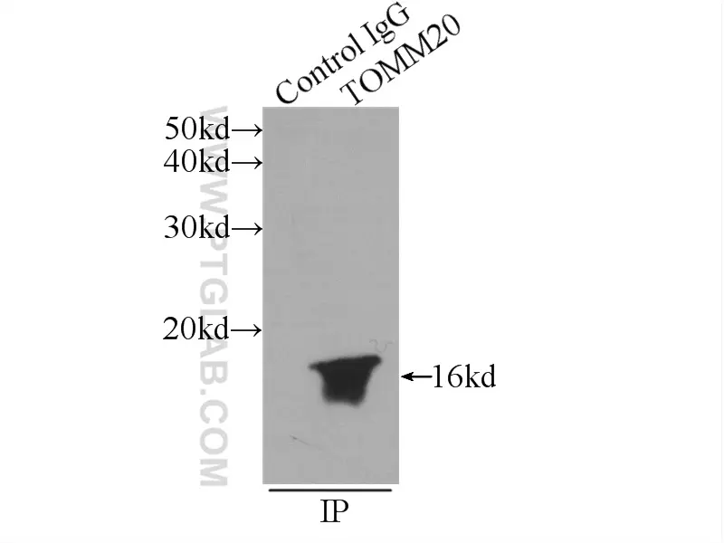 TOM20 antibody (11802-1-AP) | Proteintech