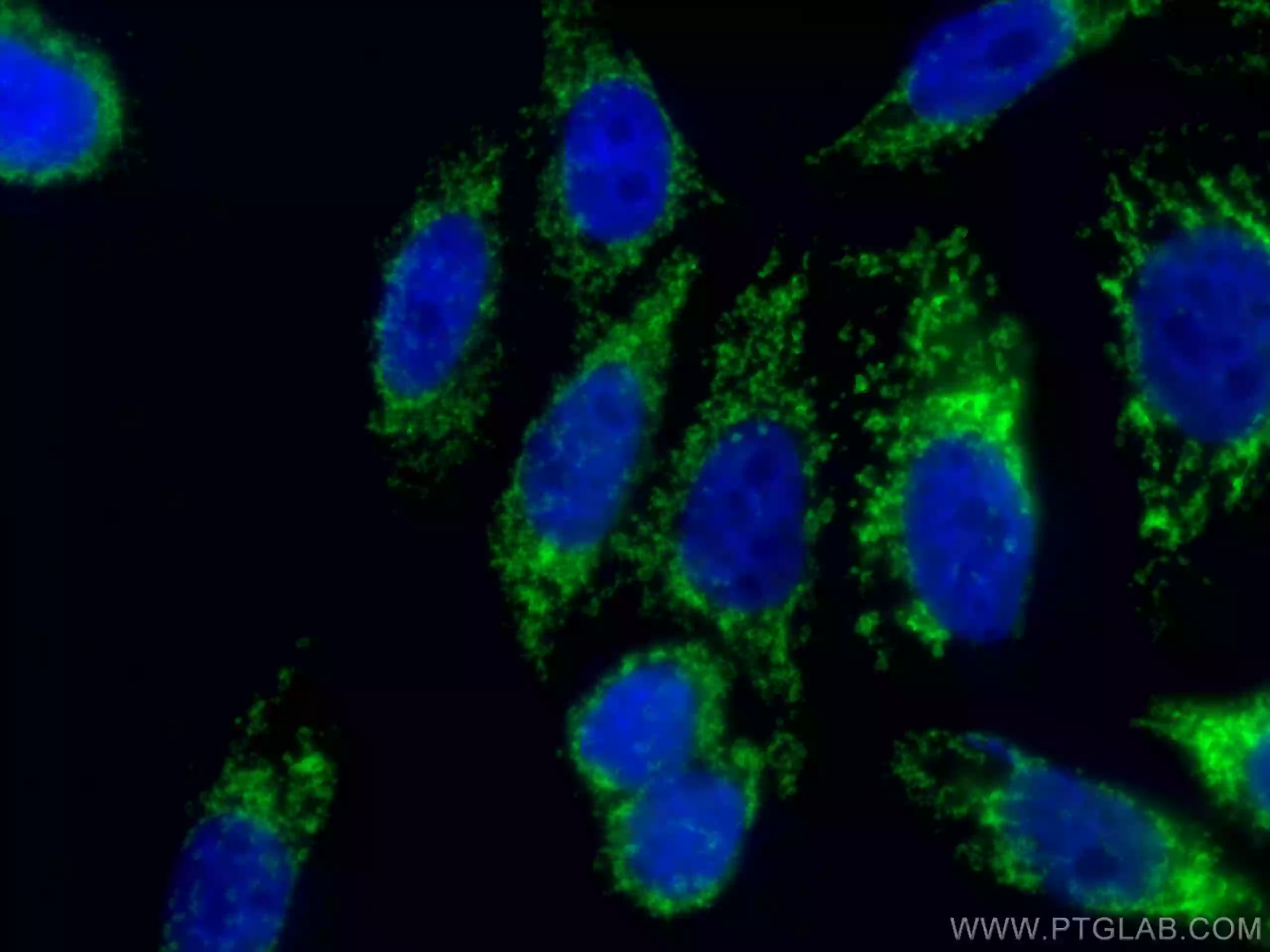 TOM20 antibody (CL488-66777) | Proteintech