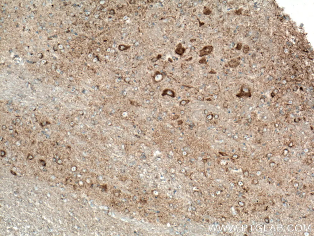 TOM70 antibody (66593-1-Ig) | Proteintech