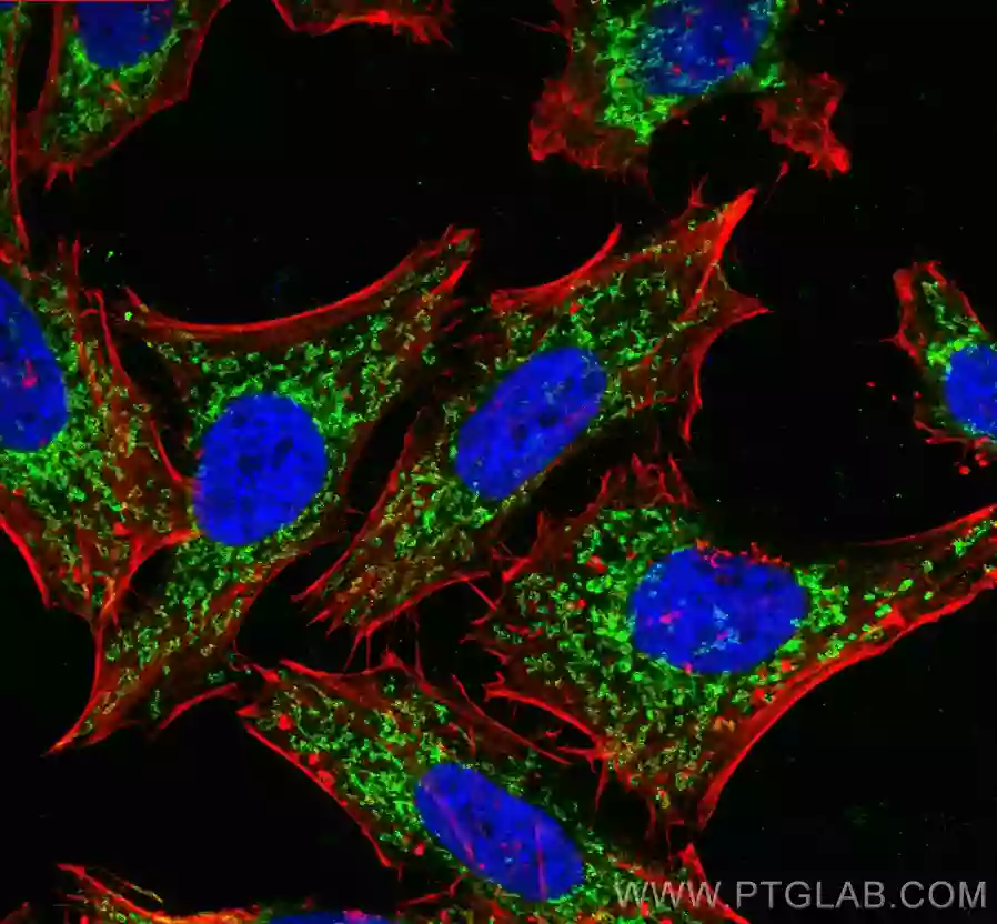Immunofluorescent analysis of  fixed HepG2 cells using TOMM40 antibody