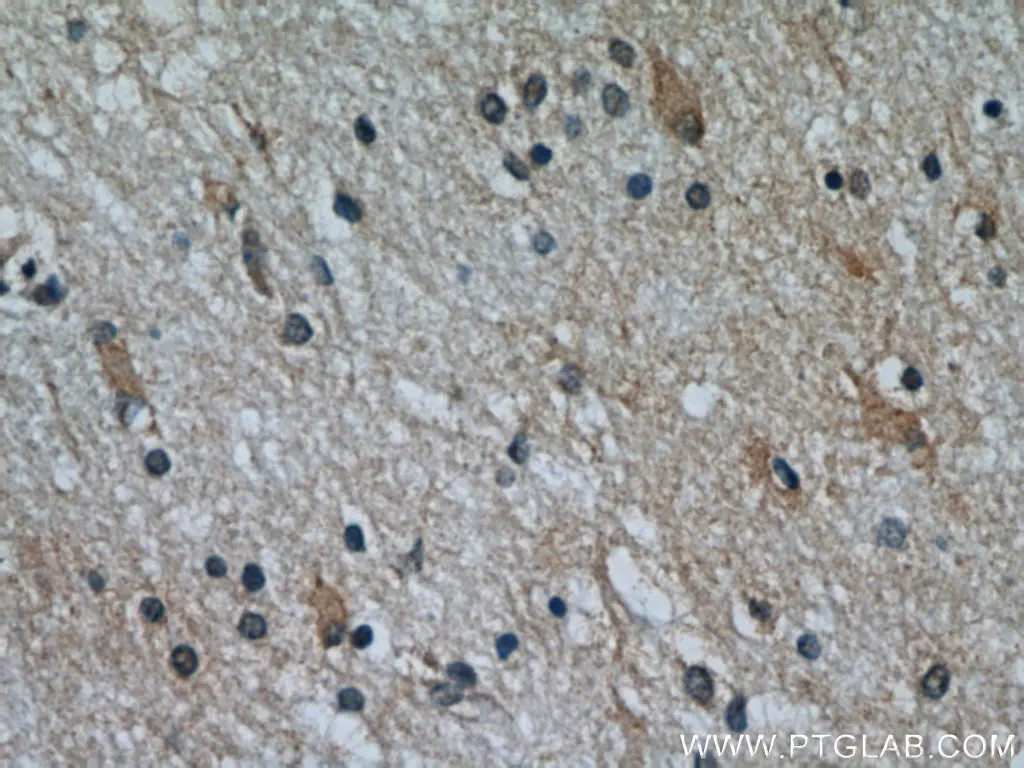 TOMM7 antibody (15071-1-AP) | Proteintech