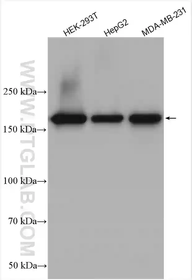 TOP2A antibody (24641-1-AP) | Proteintech