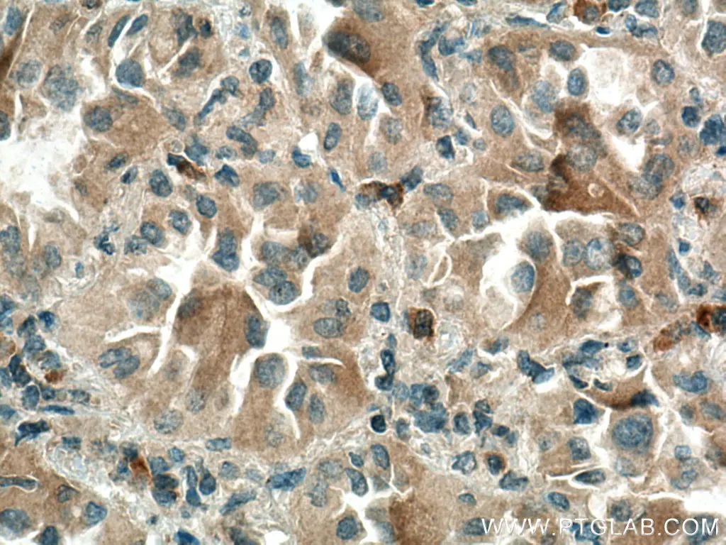 Thrombospondin 1 antibody (18304-1-AP) | Proteintech