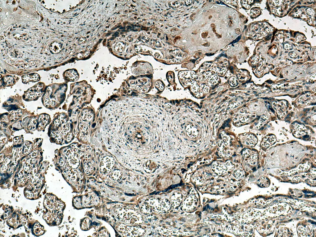 Thrombospondin 1 antibody (18304-1-AP) | Proteintech