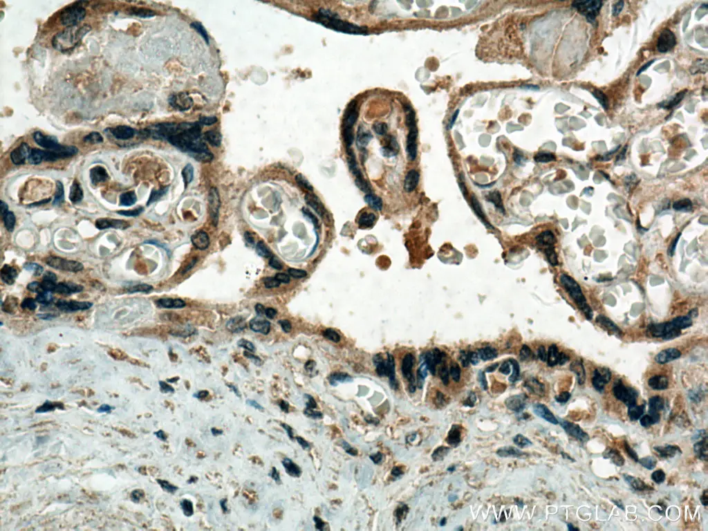 Thrombospondin 1 antibody (18304-1-AP) | Proteintech