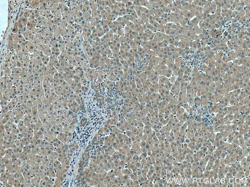 Thrombospondin 1 antibody (18304-1-AP) | Proteintech