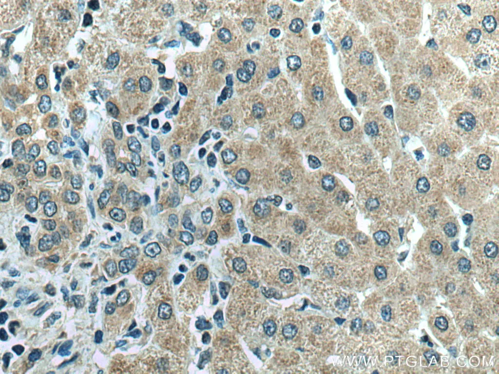 Thrombospondin 1 antibody (18304-1-AP) | Proteintech