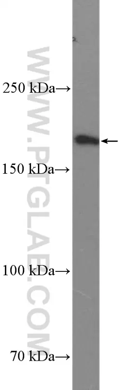 Thrombospondin 1 antibody (18304-1-AP) | Proteintech