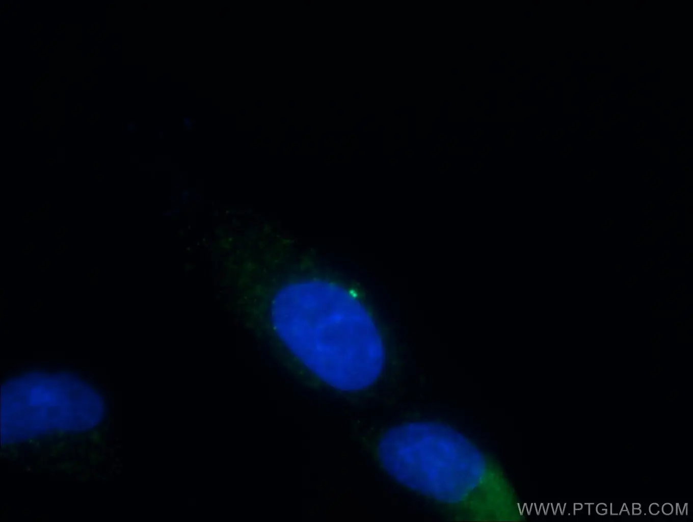 Gamma Tubulin antibody (15176-1-AP) | Proteintech