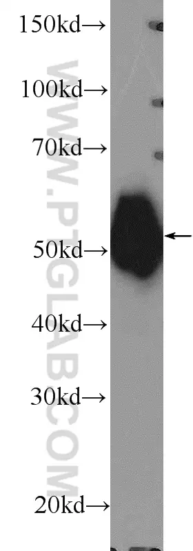 Gamma Tubulin antibody (15176-1-AP) | Proteintech