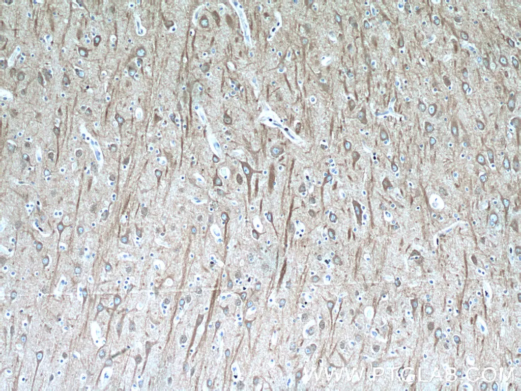 Beta Tubulin antibody (66240-1-Ig) | Proteintech