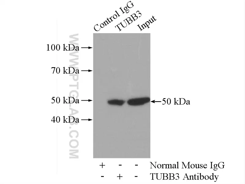 Beta Tubulin antibody (66240-1-Ig) | Proteintech