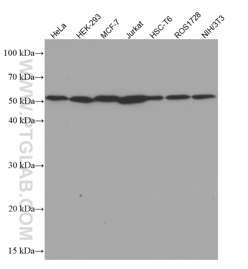 Beta Tubulin antibody (66240-1-Ig) | Proteintech