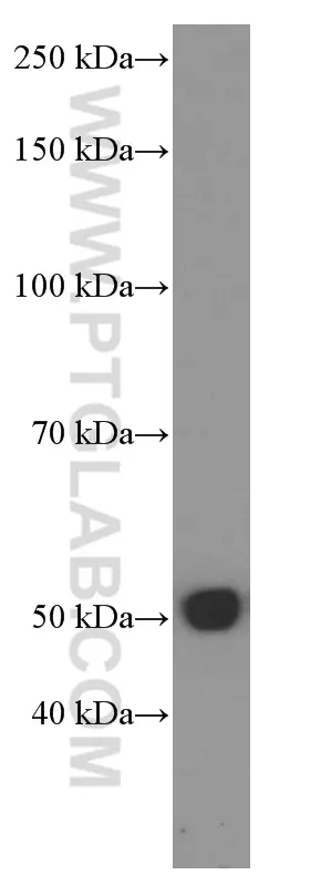 Tubulin Beta Class V antibody (66362-1-Ig) | Proteintech