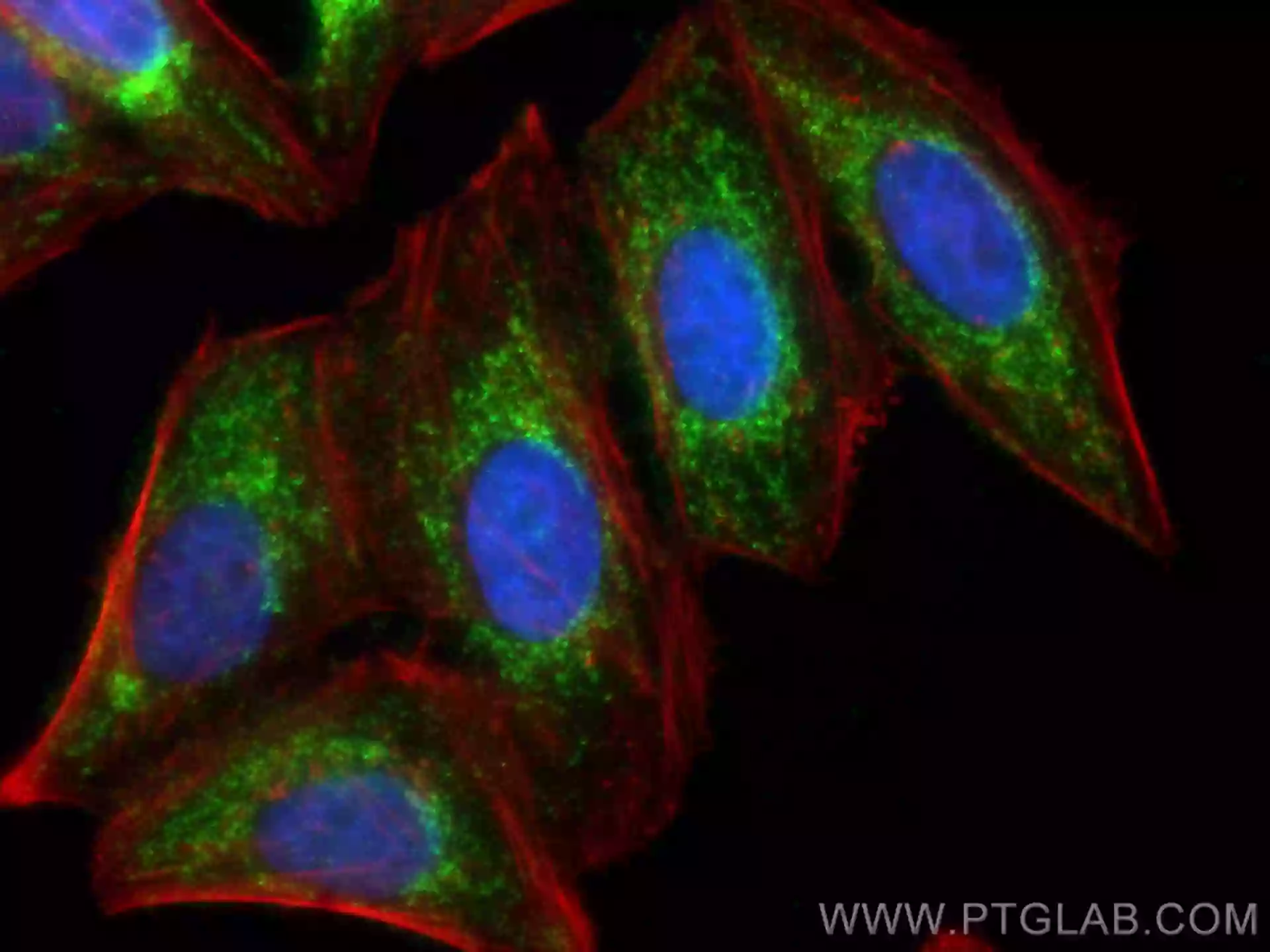 UQCRC1 antibody (21705-1-AP) | Proteintech