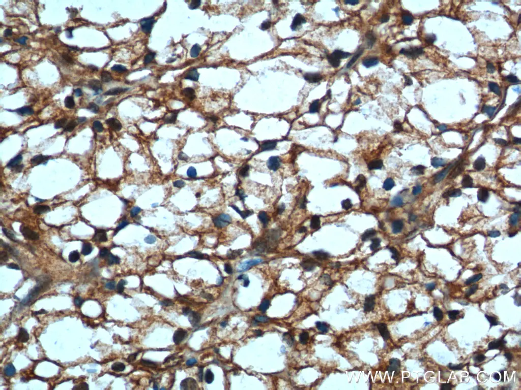 USP46 antibody (13502-1-AP) | Proteintech