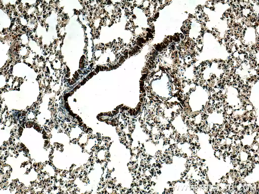 Uteroglobin/CC10 antibody (26909-1-AP) | Proteintech